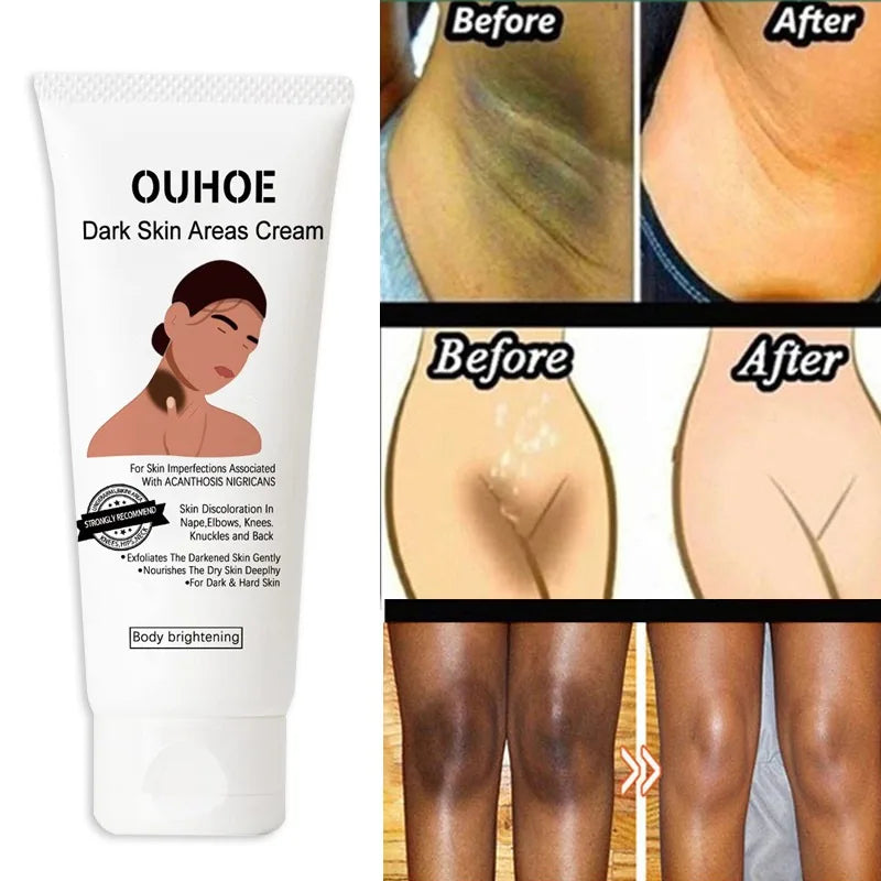 Dark Skin Brightening Body Lotion Women Moisturizing.