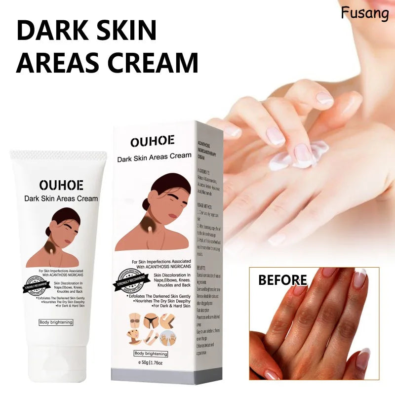 Dark Skin Brightening Body Lotion Women Moisturizing.